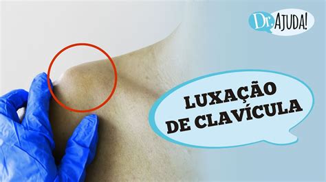 Luxa O Da Clav Cula Sintomas Diagn Stico Causas E Tratamento Youtube