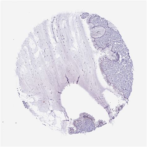 Tissue Expression Of Msmo1 Staining In Cervix The Human Protein Atlas