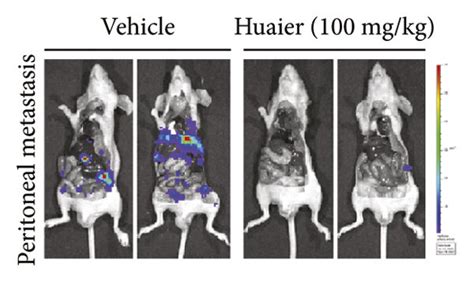 HBE Suppresses The Growth And Metastasis Of MGC803 Orthotopic Tumors