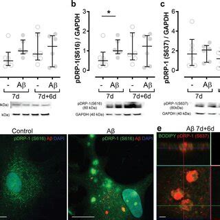 Both phosphorylation and expression pattern of DRP 1 is altered in Aβ