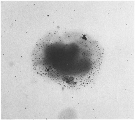 Immunoelectron micrograph of an unstained diplococcus incubated with ...