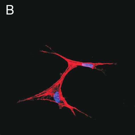 Concentration Dependent Inhibitory Effect Of Triptolide On