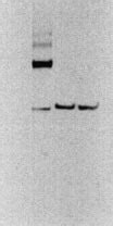 The co-regulated expression of β 2 m and FcRn HC reduces the formation... | Download Scientific ...