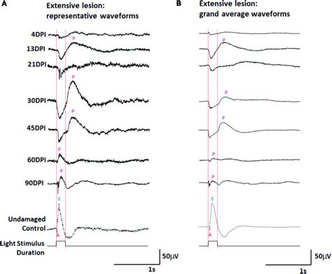 Erg Waveforms In Response To A Ms Light Flash Over An Extended