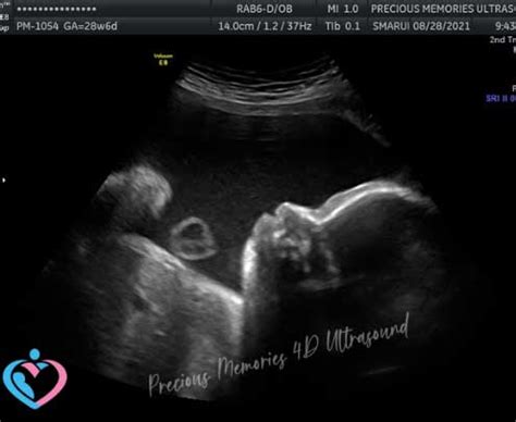 D Pregnancy Ultrasounds Atascocita Tx D Pregnancy Ultrasounds Humble Tx