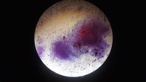 Gram Stain: Photo Gallery - Beauty in Biology