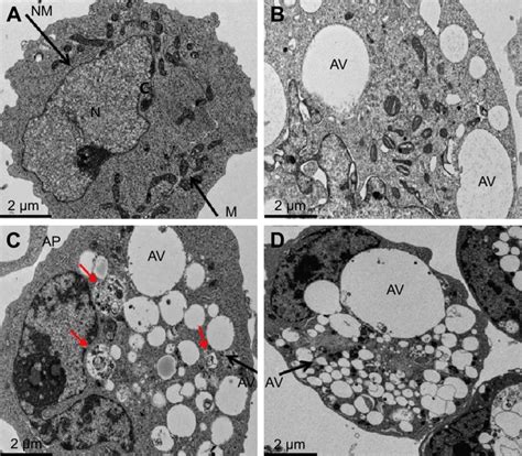 Go And Go Agnp Induced Accumulation Of Aps And Autophagic Vacuoles