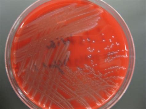 Lab Exam Listeria Erysipelothrix Trueperella Corynebacterium