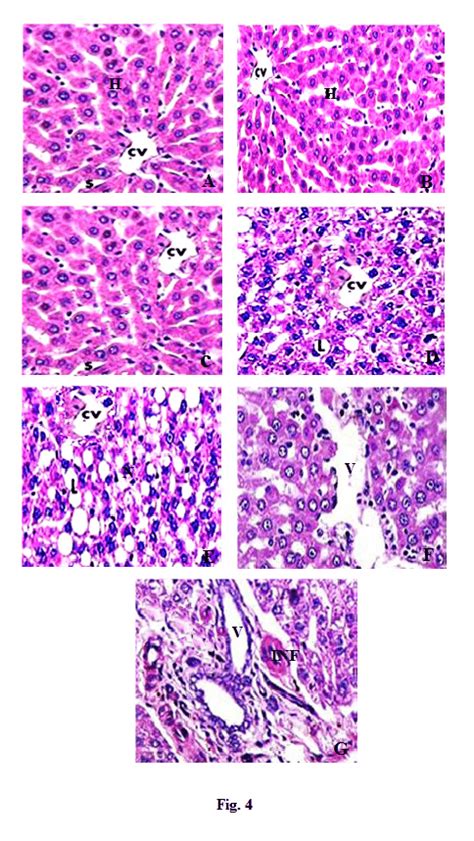 Representative Photomicrographs Of Liver Sections Of Control And Download Scientific Diagram