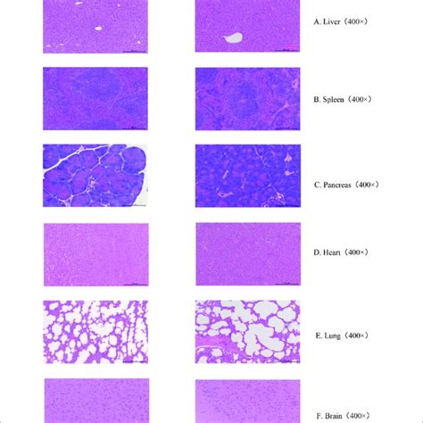 Histopathology Of Organs From Mice Injected With Pbs Or Ntsn A