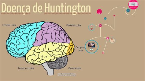 Doença De Huntington By Maria Valdez On Prezi