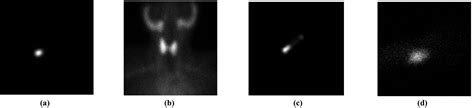 Figure 1 From An Interactive Gui Tool For Thyroid Uptake Studies Using