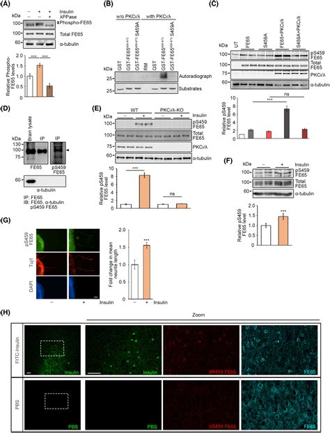 Insulin Stimulates Atypical Protein Kinase Cmediated Phosphorylation