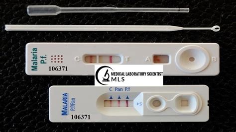 Malaria Antigen Test Principle Procedure Requirements Results And