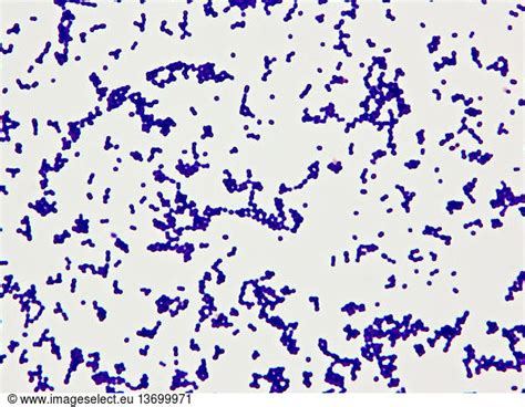 Gram Positive Bacteria Cocci Gram Positive Bacteria Are Those That