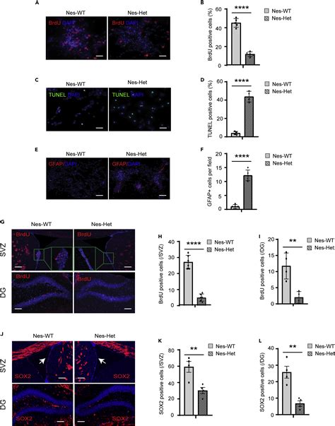 Impaired Kdm2b Mediated Prc1 Recruitment To Chromatin Causes Defective Neural Stem Cell Self