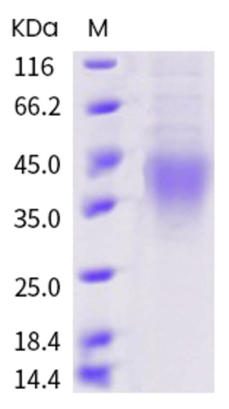 Sino Biological Human Cynomolgus Rhesus Cd Protein Ecd His Tag