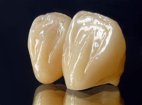 What Is A Zirconia Crown Heritage Park Dental Dentist In Palo Alto