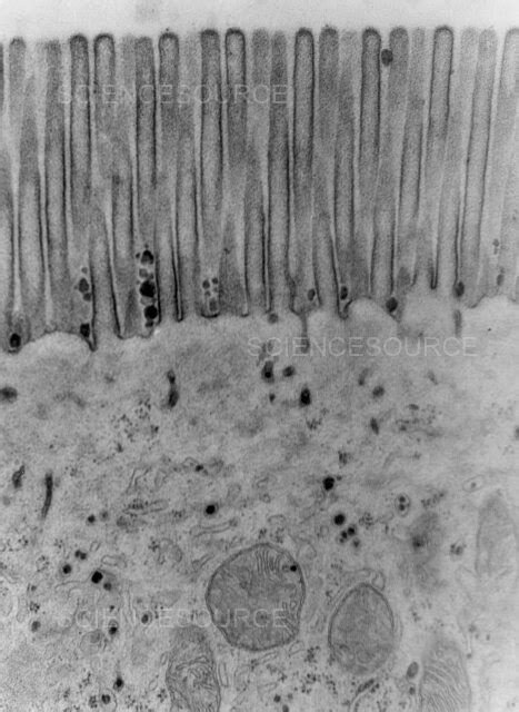 Photograph | Brush Border of Epithelial Cell TEM | Science Source Images