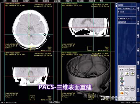 医院影像图像科室工作站pacs系统源码 Dicom 三维图像后处理与重建 知乎