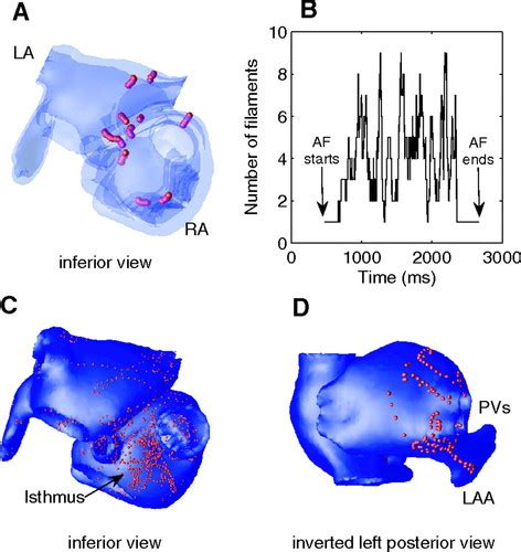 Mechanism Underlying Initiation Of Paroxysmal Atrial Flutter Atrial