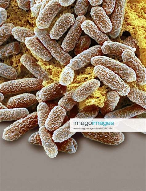 E Coli Bacteria Sem Escherichia Coli Bacteria Coloured Scanning Electron Micrograph Sem