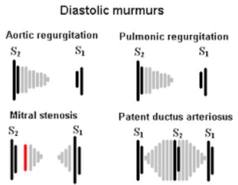 Cardiac Findings Class Flashcards Quizlet