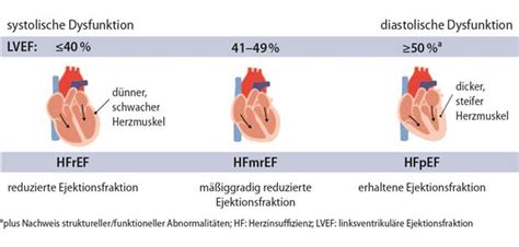 Chronische Herzinsuffizienz In Der Haus Rztlichen Versorgung