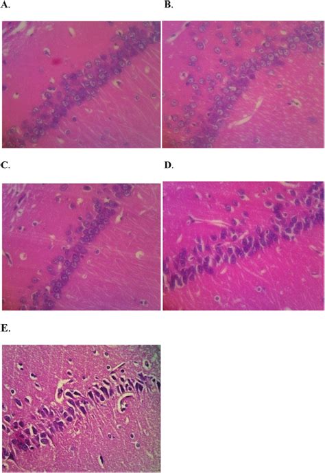 Histological Sections Of CA1 Region A Normal Control B