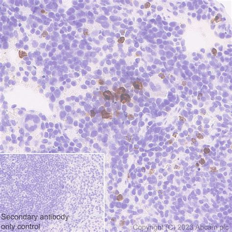 Recombinant Anti Neutrophil Elastase Antibody Epr Ab