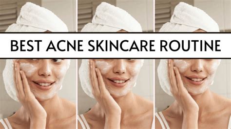 The Lazy Easy Acne Skincare Routine You'll Ever Try! (2021)