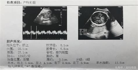 彩超nt值等于15是男孩还是女孩（孕期6次彩超全分享：双顶径、股骨长、胎心率，是否有规律可循） 说明书网