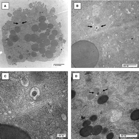 Gene Expression Profi Les In Primary Human Granulosa Cells In Relation Download Scientific