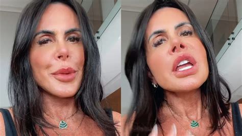 Ap S Outra Harmoniza O Gretchen Aparece O Rosto Mais Fino E