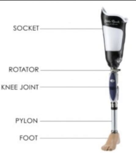 Prosthetics Flashcards Quizlet