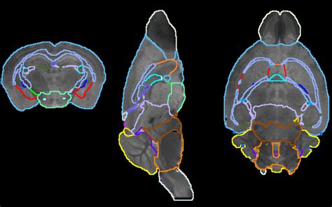 Pdf The Neuroterrain 3d Mouse Brain Atlas Semantic Scholar 49 Off