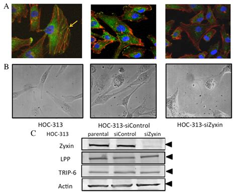 Corrigendum Functional Analysis Of Zyxin In Cell Migration And