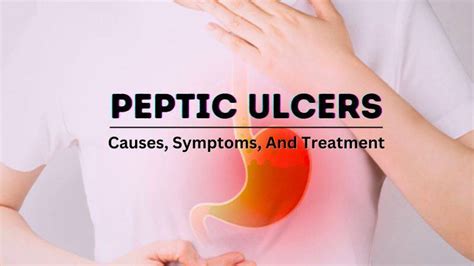 Ulcers Causes Symptoms And Treatment