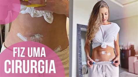 Cirurgia De Endometriose Meu Relato YouTube