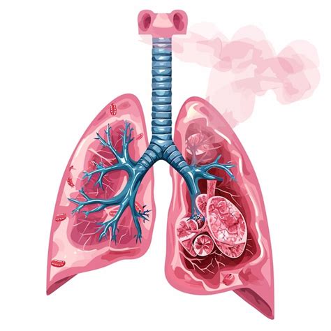 Premium Vector Lung Cancer Diagram In Details Vector