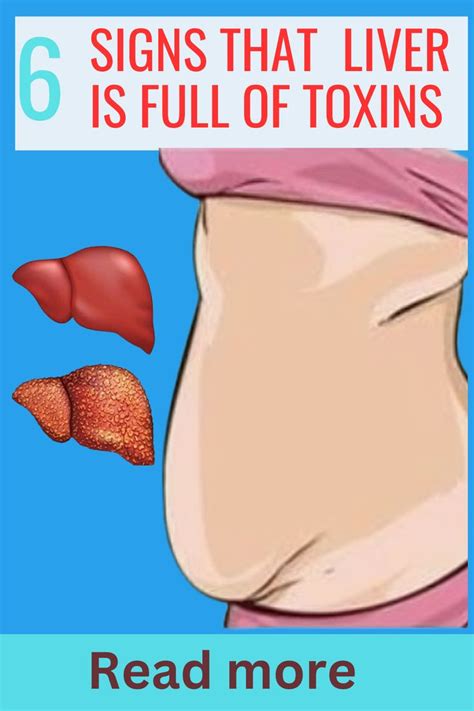 6 Warning Signs That Your Liver Is Full Of Toxins Womens Health Awareness Womens Health