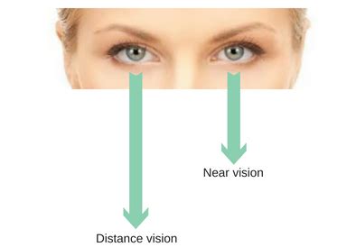 Monovision RLE - Insight Eye Clinic