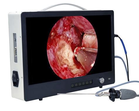 Procesador De V Deo Para Endoscopia Camlight Hd Vertical