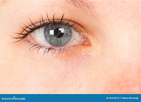 Women Eye, Close-up, Blue, Tear Royalty Free Stock Photo - Image: 26412675