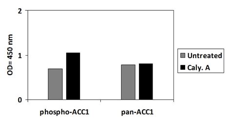 Human Rat Phospho Acc S And Total Acc Elisa Kit Raybiotech