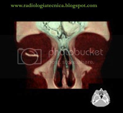 Técnicas Radiológicas y Avances TC SCANER