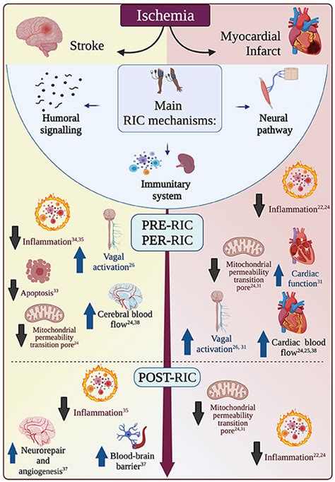 Frontiers Remote Ischemic Conditioning In Ischemic Stroke And