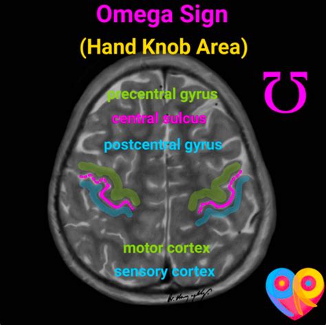 Postcentral Gyrus Mri