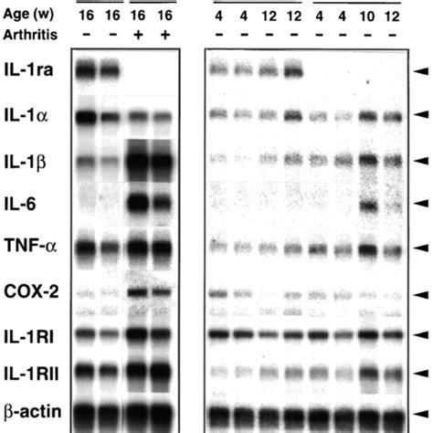 Augmentation Of Il 1β Il 6 Tnf α Cox 2 And Il 1r Mrna Expression In