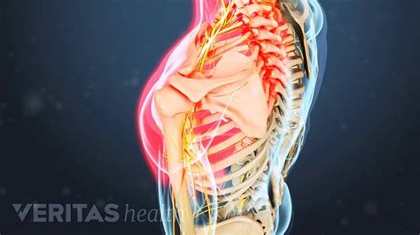 Cervical Herniated Disc Symptoms and Treatment Options